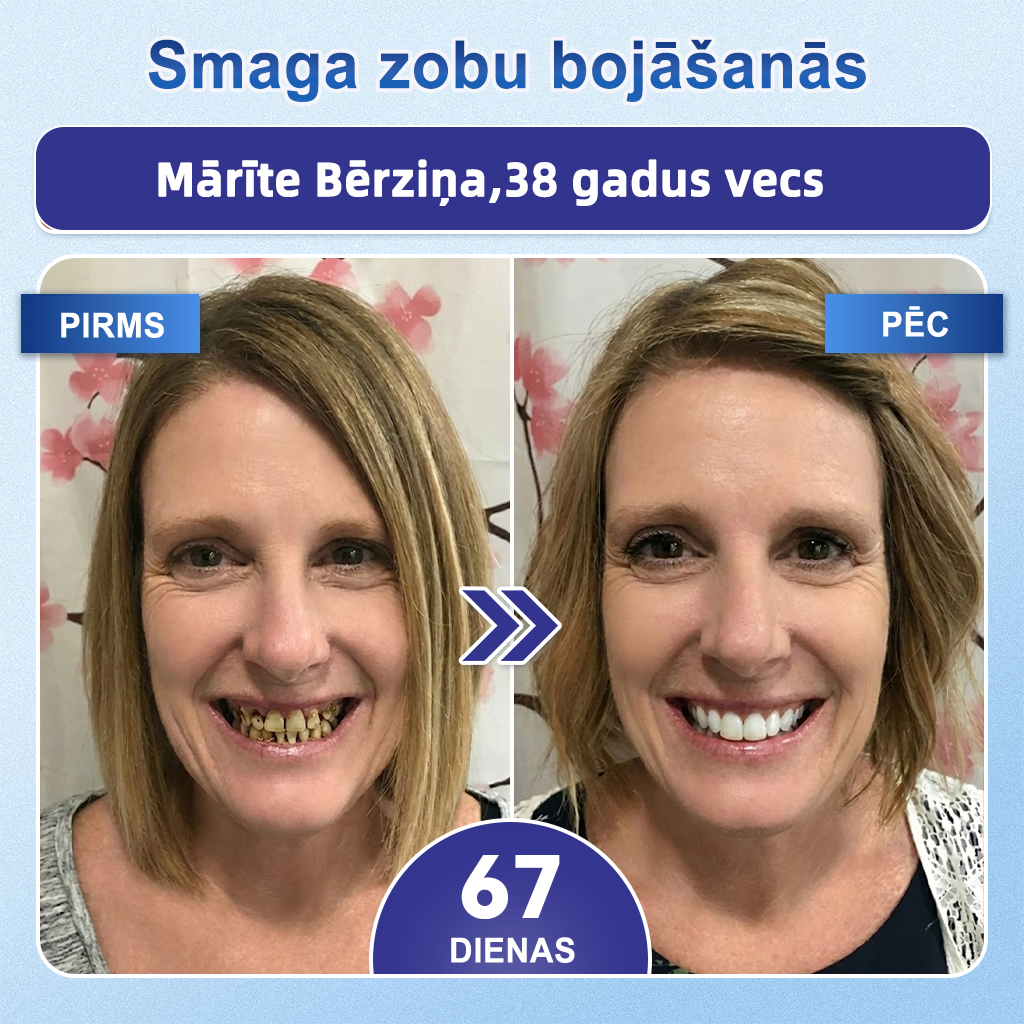 GarageLine®🦷8️⃣ TIDEGLUSIB ZOBU UN SMAGANU NanoLabošanas Šķīstošās Balinošās Sloksnes✨ (Atbalsta zobu atjaunošanu un palīdz mazināt smaganu diskomfortu un citas bieži sastopamas mutes dobuma problēmas