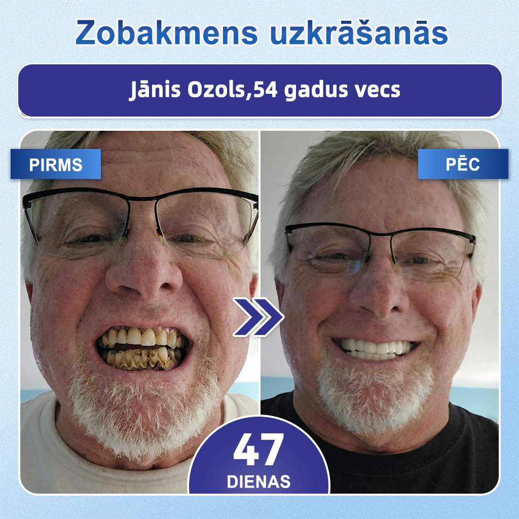 GarageLine®🦷8️⃣ TIDEGLUSIB ZOBU UN SMAGANU NanoLabošanas Šķīstošās Balinošās Sloksnes✨ (Atbalsta zobu atjaunošanu un palīdz mazināt smaganu diskomfortu un citas bieži sastopamas mutes dobuma problēmas
