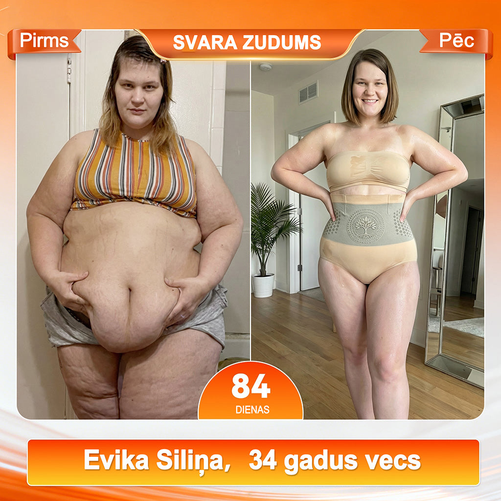Oficiālais veikals ⭐🍦✅𝐋𝐔𝐂𝐊𝐘𝐒𝐎𝐍𝐆® 𝟐𝟎𝟐𝟔 𝐌𝐨𝐫𝐢𝐧𝐠𝐚 𝐁𝐐𝐢: "Četri vienā" (4-in-1) koriģējošie legingi tūlītējai silueta veidošanai un tauku dedzināšanai ar mikrodaļiņām